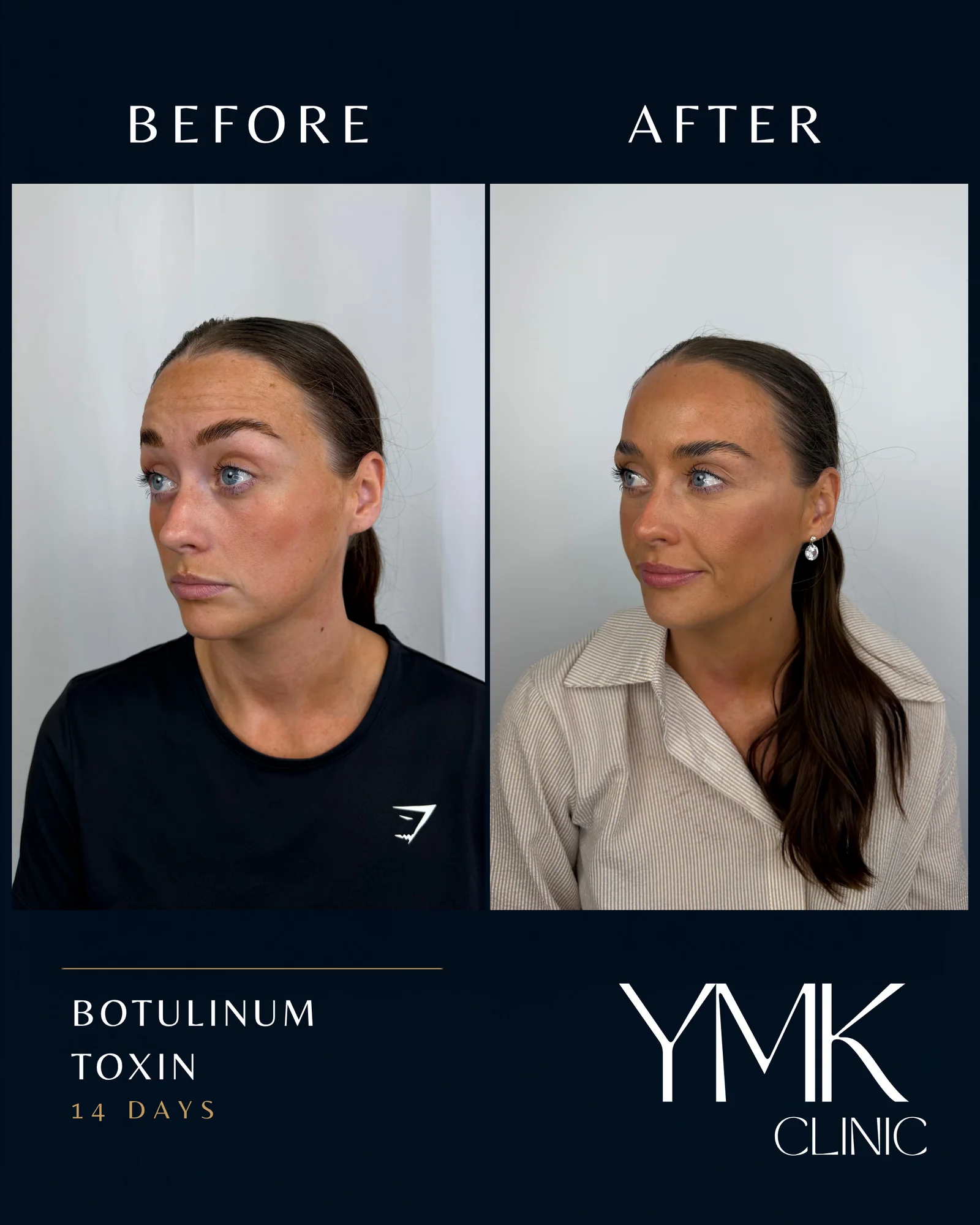 Before and after photographs, case 004.