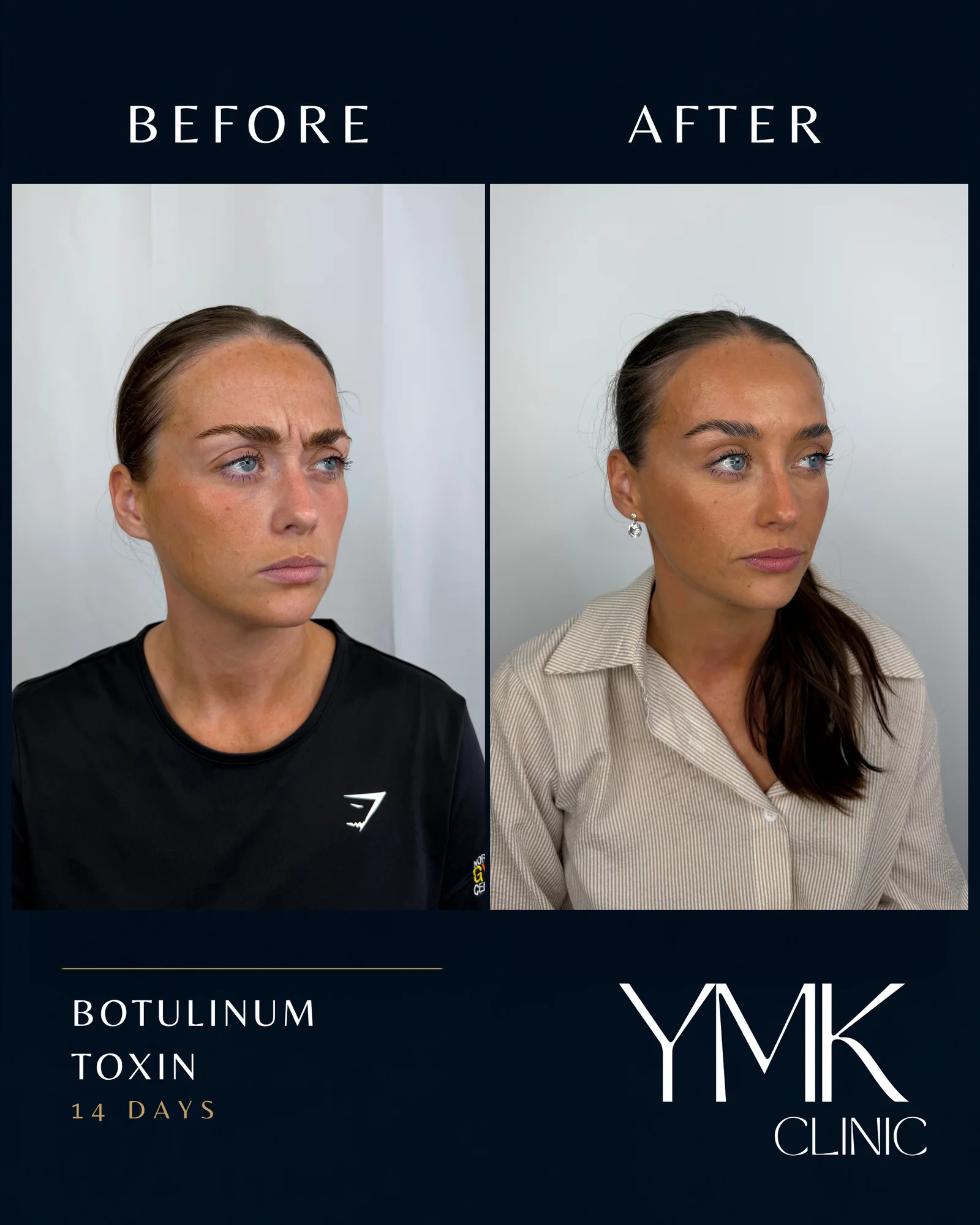 Before and after photographs, case 004.