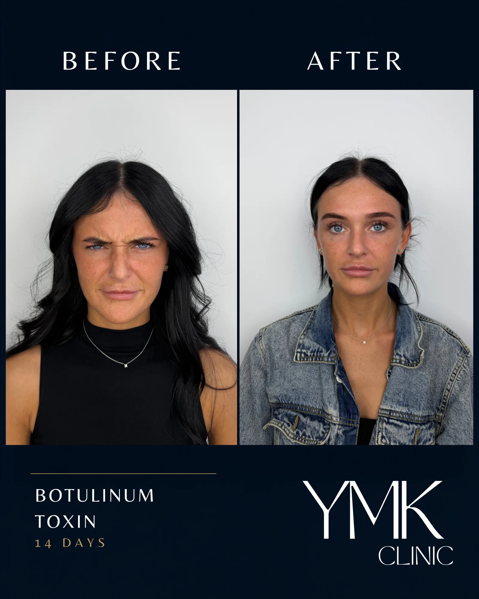 Before and after photographs, case 005.